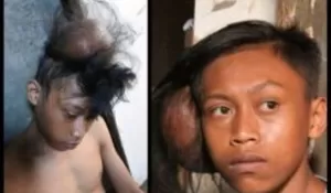 Ortu cuma Jualan Sapu Lidi, Nahya Butuh Pertolongan