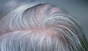 Tanpa Perlu Diwarna untuk Menutupinya, 5 Bahan Alami yang Mampu Menghilangkan Rambut Uban