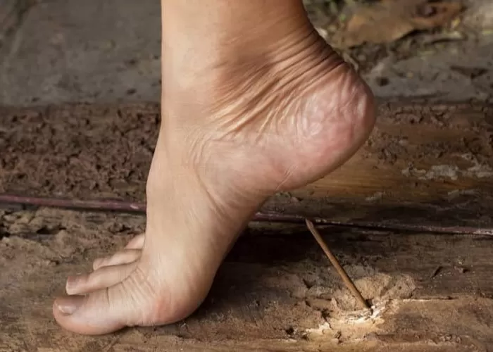 Tertusuk Paku Berkarat dapat Meningkatkan Risiko Terkena Tetanus (twitter @afrkml)