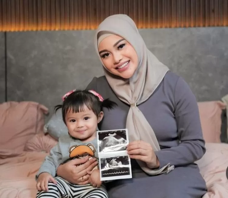 Aurel Hamil Anak Kedua (GENMUSLIM.id/dok: Instagram @aurelie.hermansyah)