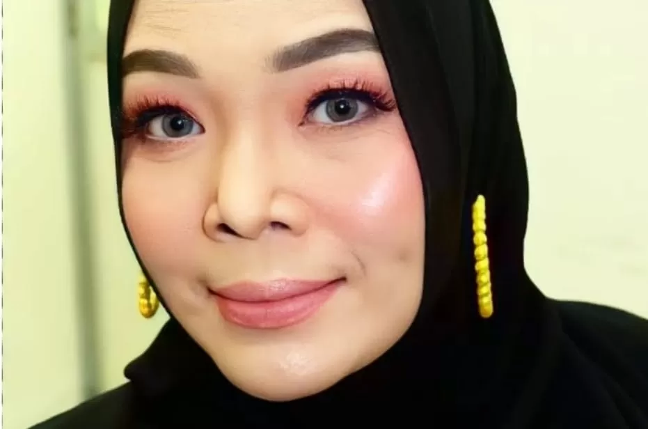 Potret mendiang penyanyi dangdut Yunita Ababiel yang meninggal karena sakit kanker payudara. (Instagram/yunitaababiel)