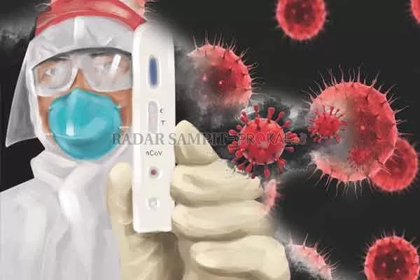 ILUSTRASI.(RADAR SAMPIT)