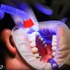 Cara Merawat Gigi Berlubang, Lebih Baik Dicabut atau Ditambal? Simak Penjelasan Berikut Ini