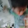 Viral Video Kaki Anak Disabilitas di Bitung Dibakar, Pelaku Ternyata Saudara Sendiri