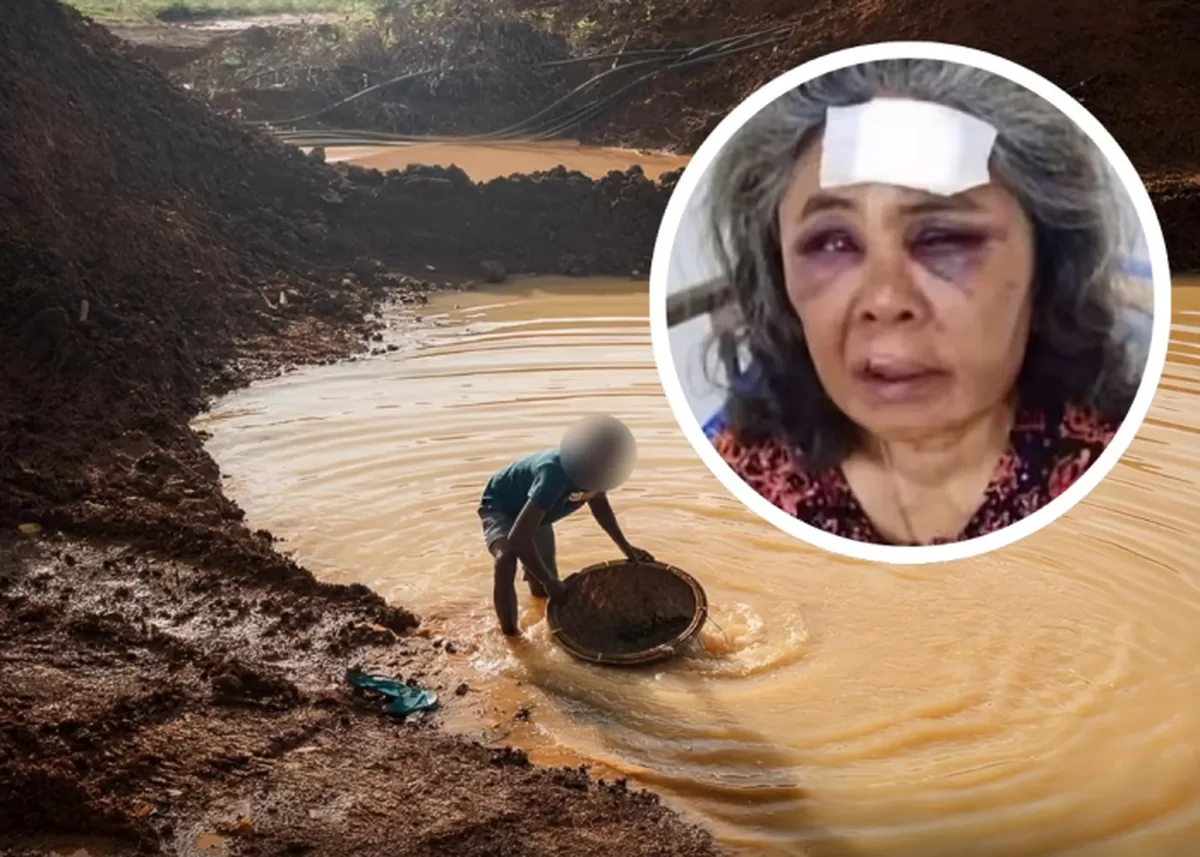 Kondisi Nenek Saudah (68), warga Pasaman, Sumatera Barat, usai diduga menjadi korban pengeroyokan setelah menolak aktivitas tambang emas ilegal di tanah miliknya. (Instagram/lengahdiki)