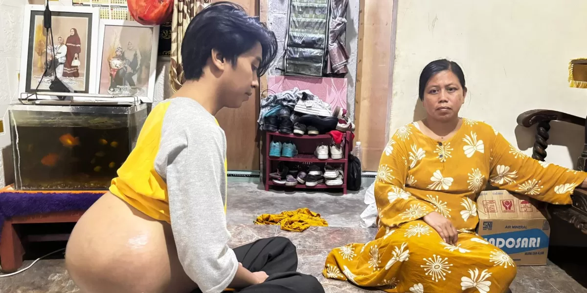 Muhammad Dava Nuri Saputra bersama ibunya di rumah sederhana mereka di Probolinggo, berharap dukungan untuk biaya pengobatan tumor. (X/Probolinggo)