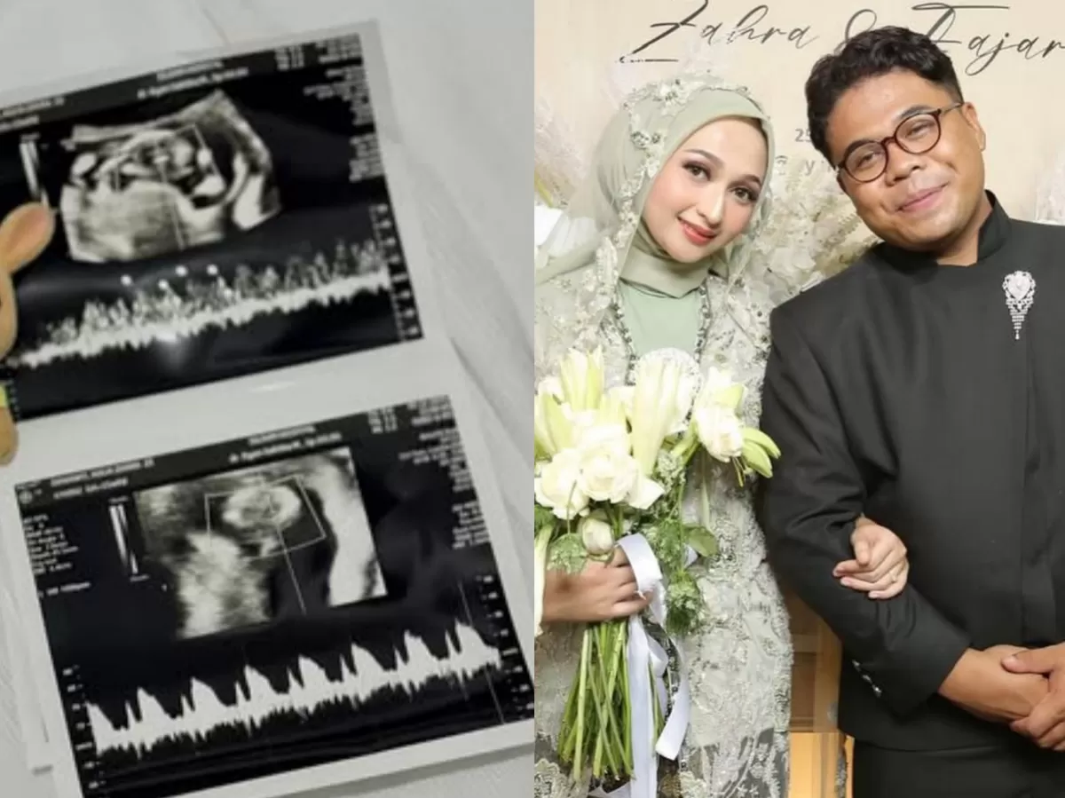 Potret Zahra MCL yang dikabarkan hamil anak pertama. (Instagram/@zahra.mci12)
