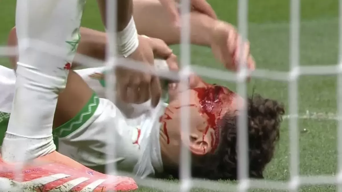 Neil El Aynaoui menjadi korban kerasnya Piala Afrika 2026.