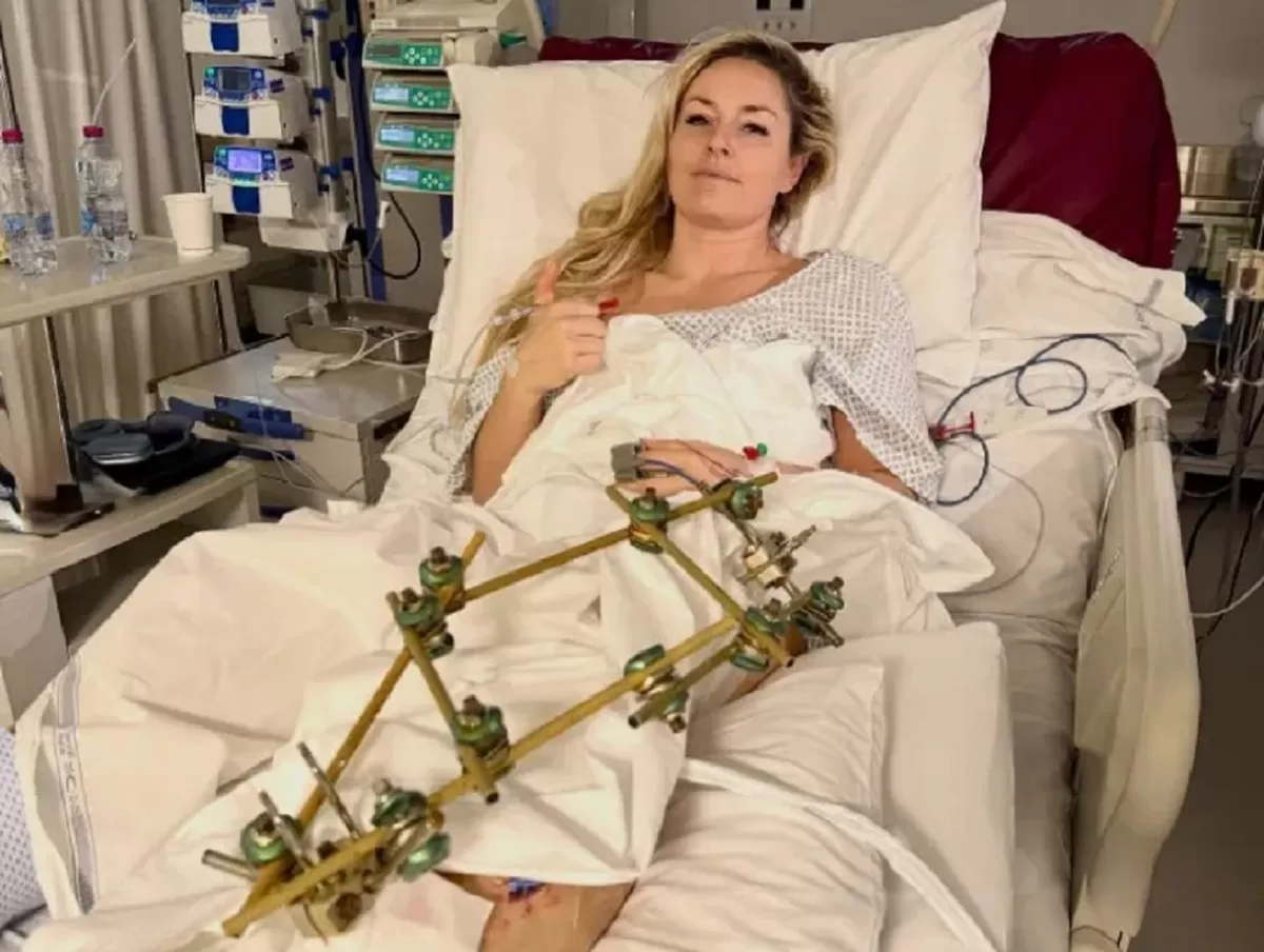 Lindsey Vonn menjalani operasi ketiga setelah kecelakaan mengerikan di Olimpiade Musim Dingin. (instagram)
