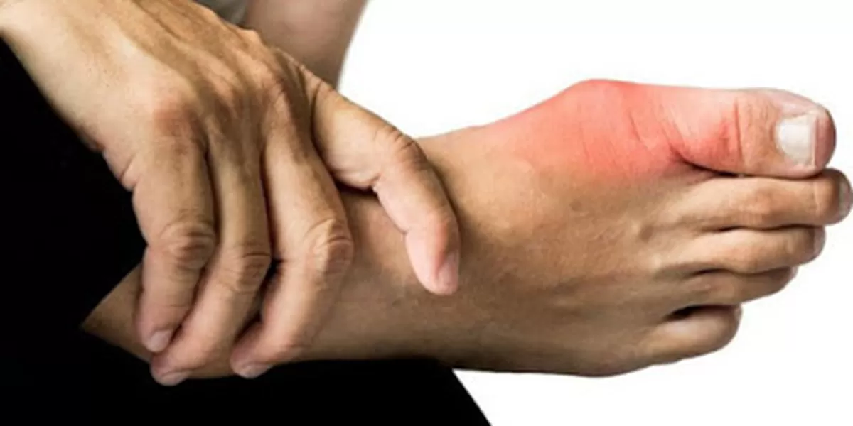 ilustrasi nyeri Rematik Asam Urat. (Batamxinwen.com)