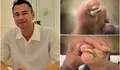 Bikin Ngilu! Raffi Ahmad Mendadak Unggah Foto Kuku Jempol Kaki Patah, Netizen Soroti Kesibukan Sultan Andara hingga Singgung soal Rumor Pencucian Uang