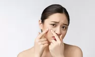 3 Tips Menghilangkan Jerawat Hanya Semalam, Buat Kamu yang Punya Agenda Penting Esok Hari