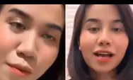 Mayang unggah video hasil oplas hidung 50 juta, sebelum dan sesudah operasi. Netizen: Cantik banget Mayang…