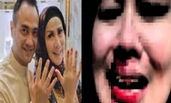 Viral foto dugaan KDRT yang dialami Venna Melinda, netizen tuding Ferry Irawan lupa janji pernikahan