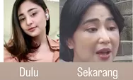 Heboh! Wajah Dewi Persik Jadi Aneh dan Bengkak, Ternyata Karena Calon Suami