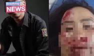 Diduga Ditabrak Sengaja Oleh Kekasihnya Gegara Cemburu, Polisi Masih Dalami Kasusnya
