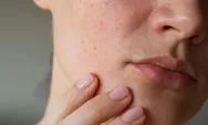 Hindari! 7 Kebiasaan Buruk Bisa Merusak Wajah