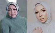 Melly Goeslaw Potong Lambung, Berat Badan Turun 34 Kg, Operasi Apakah Itu?