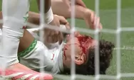 Piala Afrika Makan Korban, Wajah Pemain Maroko Berlumuran Darah 