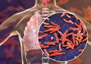 Kasus TB di Indonesia Terbesar Kedua di Dunia
