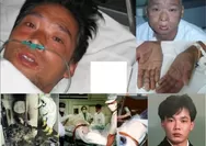 Kisah Hisashi Ouchi, Manusia Paling Radioaktif yang Tidak Memiliki DNA