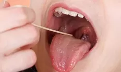 Cara Obati Radang Tenggorokan Pakai Bahan Alami, Dijamin Langsung Sembuh