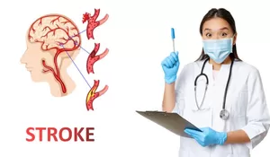 Catat, Gejala Awal Penyakit Stroke yang Harus Diwaspadai