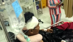 Dibacok Gerombolan Bermotor, Anak Petinggi PP Sukabumi Alami Luka Serius