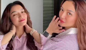 Tampil Makin Muda Dengan Tubuh Ideal, Siti Badriah Akui Baru Pulang Korea Karena Insecure Usai Lahirkan Anak Kedua, Operasi Plastik?