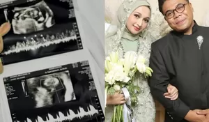 Zahra MasterChef Indonesia Umumkan Kehamilan Anak Pertama,  Unjuk Hasil USG Banjir Ucapan
