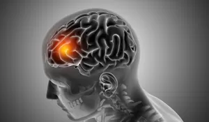 Waspada! Kebiasaan Ini Bisa Menurunkan Kecerdasan dan Merusak Fungsi Otak