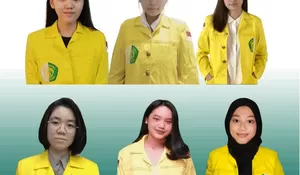 Mahasiswa FKG UI Buat Inovasi Perawatan Rekonstruksi Celah Bibir