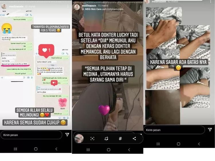 Unggahan Medina Zein soal KDRT yang diduga dilakukan suaminya.