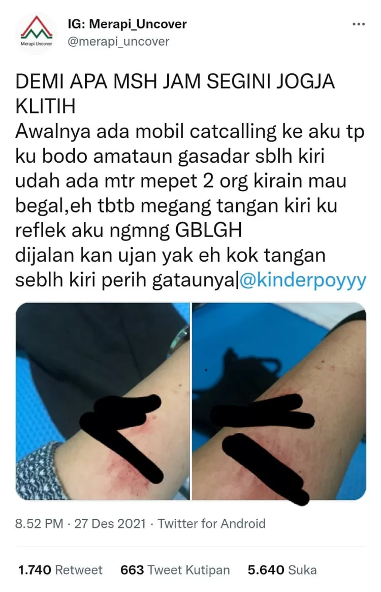 Jogja Darurat Klitih, Tangan Wanita Ini Luka Robek Usai Dipepet 2 Pengendara Motor