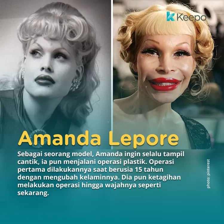 Amanda Lepore yang gagal operasi plastik