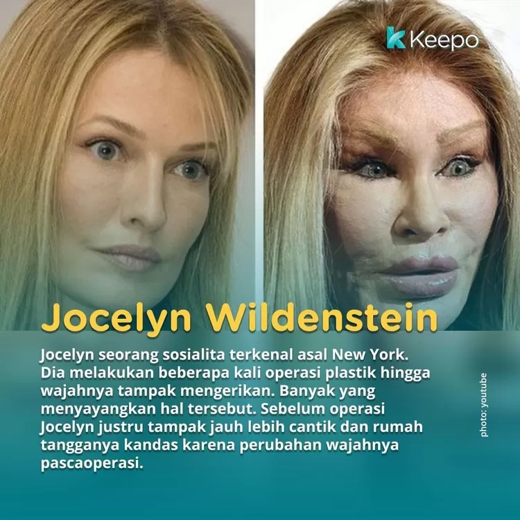 Jocelyn Wildenstein yang gagal operasi plastik