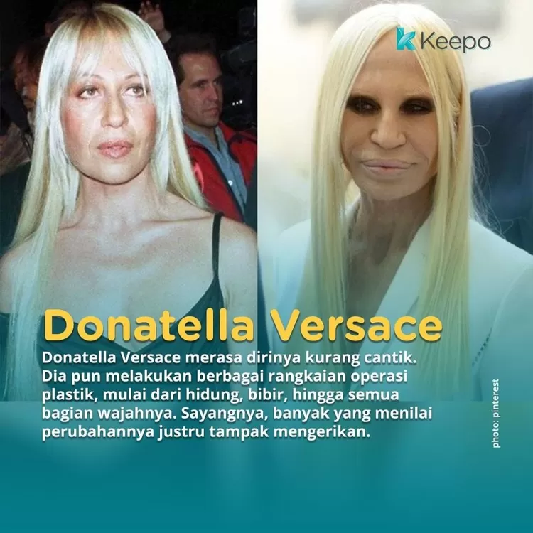 Donatella Versace yang gagal operasi plastik