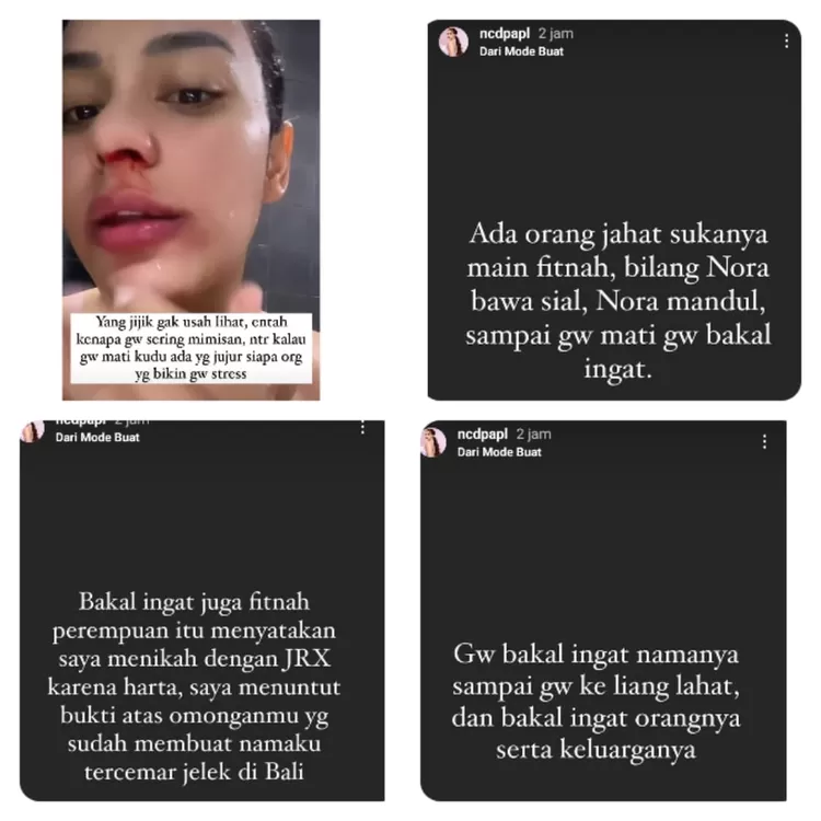 Nora Alexandra curhat soal kondisinya.