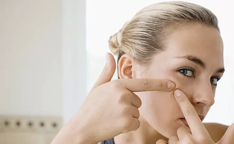 Ilustrasi memencet jerawat