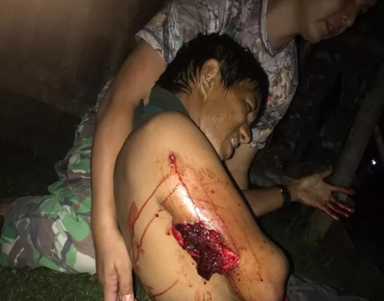 Satu Pekerja Jalan Ditembak OTK.  TKP di Jalan Trans Bintuni ke Maybrat Papua Barat