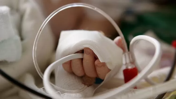7 fakta dugaan malpraktik jari bayi putus oleh perawat RS Muhammadiyah Palembang.