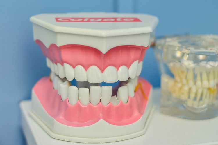 Apa yang Harus Dilakukan Jika Gigi Berlubang? Cek Penyebab, Cara Mencegah dan Mengobatinya