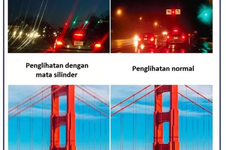 Mata Silinder Inilah Penyebab Mata Silinder Dan Cara Mengatasinya