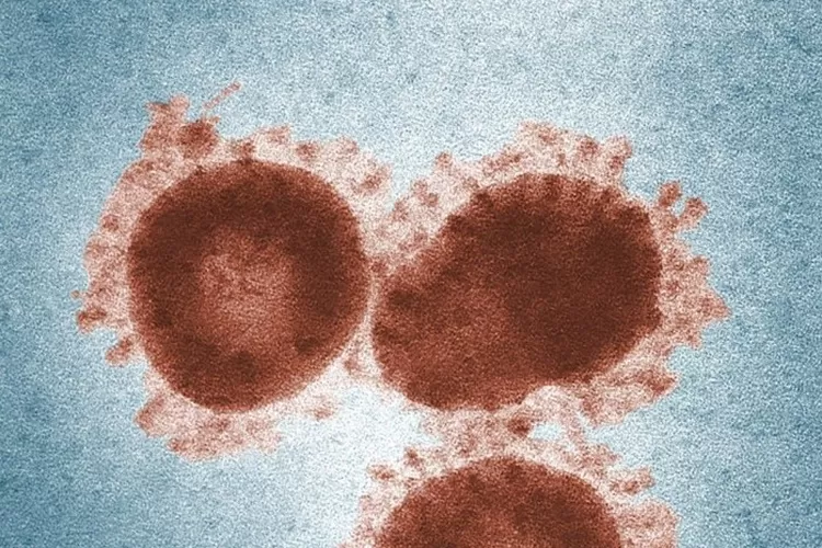  Ilustrasi Covid-19 varian Mu.  (Pexels )