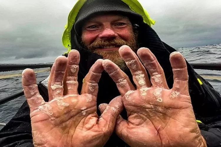 Petualangan Dave Bell ditandai dengan perjuangan, termasuk badai hingga sengatan ubur-ubur.*  (Twitter /Dave &lsquo;Dinger&rsquo; Bell)