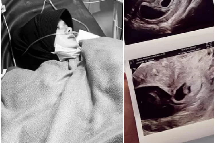 Dinda Hauw (Instagram @dindahw)