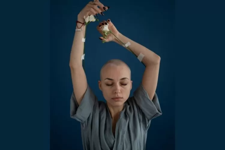 Ilustrasi Kobatakan di Kulit Kepala yang Dapat Dialami oleh Pasien Penderita Penyakit Alopecia (pexels.com/SHVETSProduction)