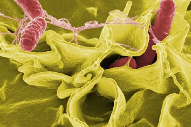 Bakteri salmonella (fixabay)
