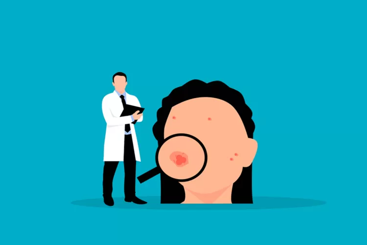 Kenali Masalah pada kulit pada anak (pixabay)