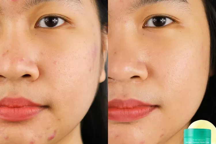 Merawat kulit wajah terlihat sehat dan awet muda ala Dear Me Beauty.  (Dok Dear Me Beauty)